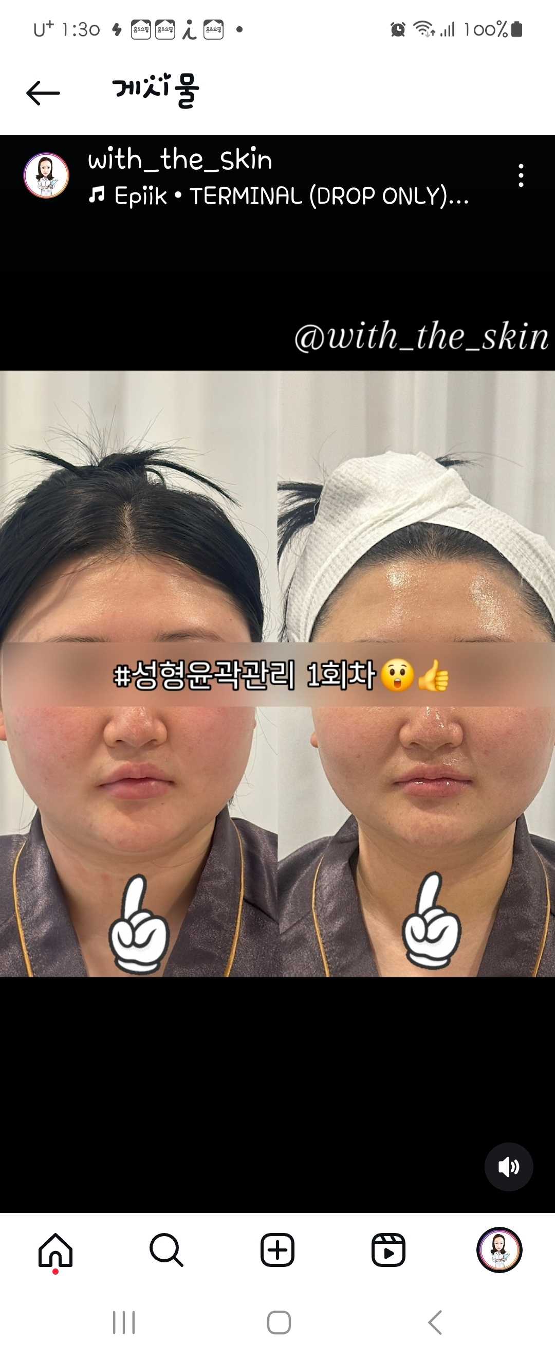 위더스킨