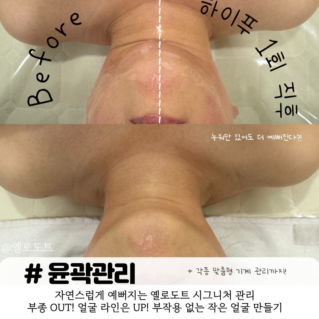 옐로도트