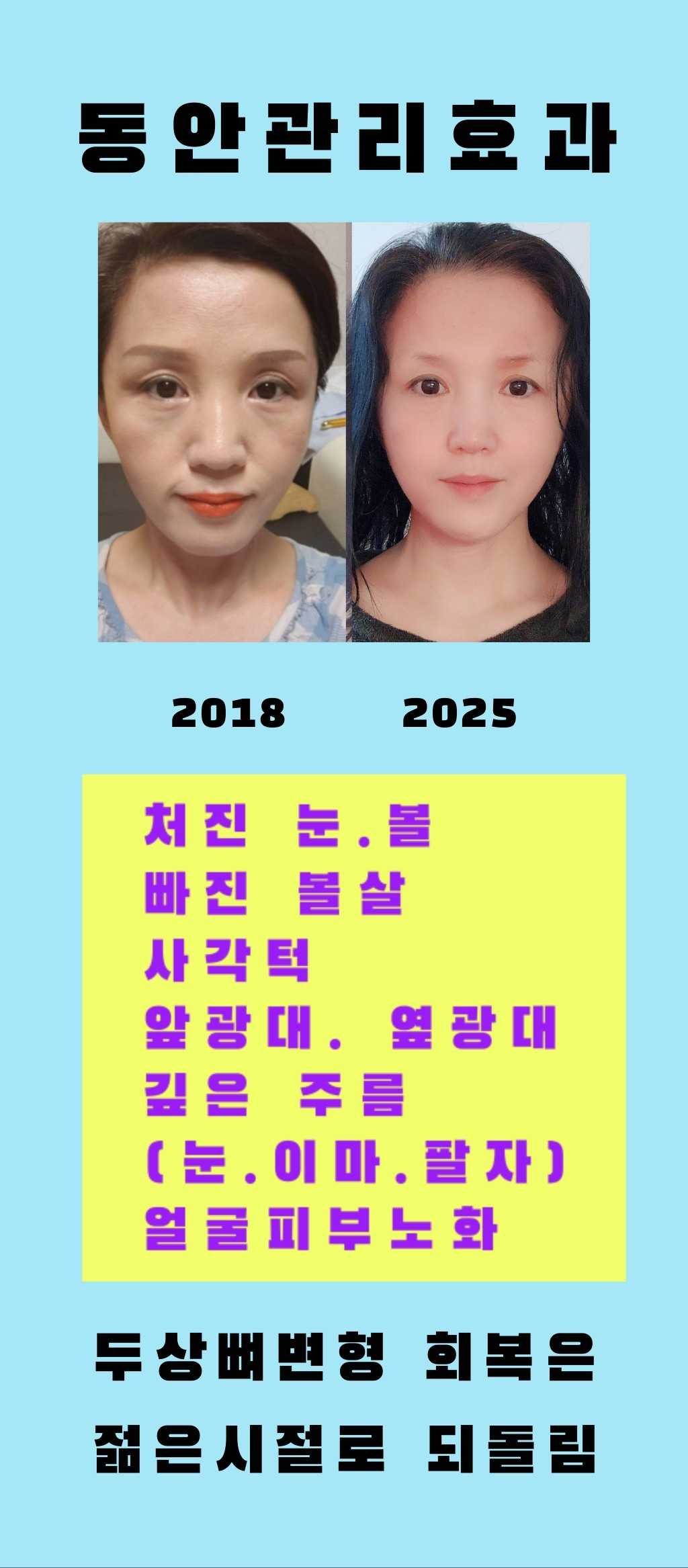 스킨앤바디 신의손 