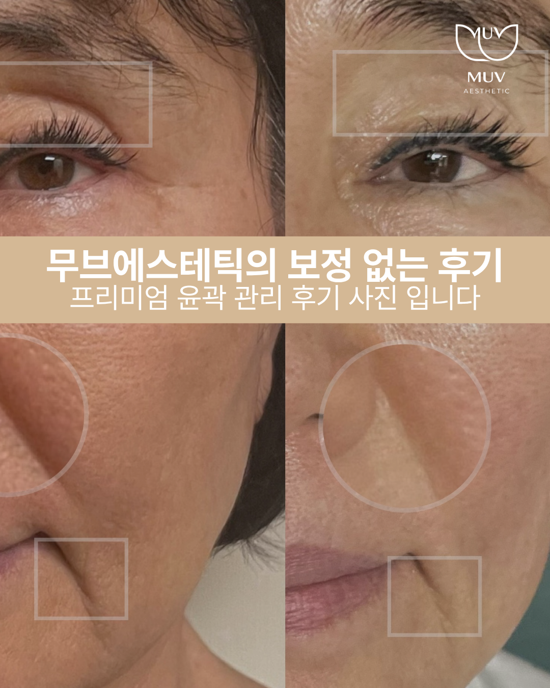 무브에스테틱
